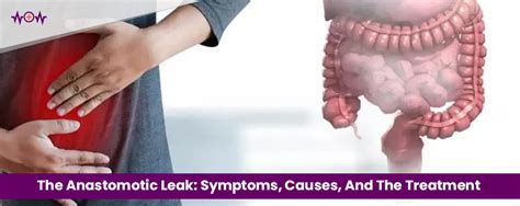 Anastomotic Leak: Symptoms, Treatment & What It Is